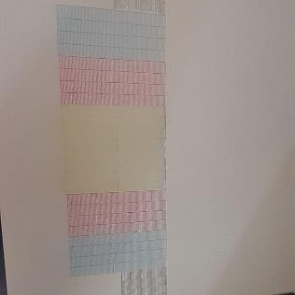 دستگاه اکوسالونت اولترا900 سبزوار